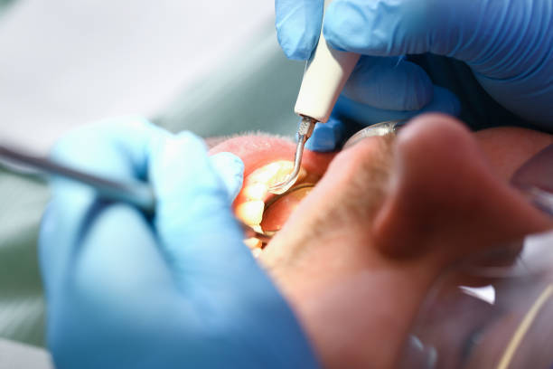 Best Emergency Treatment for Dental Infections or Abscesses in Willow, AK
